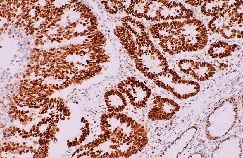 immunohistochemistry-techniques-strengths-limitations-and-applications-363107-960x540